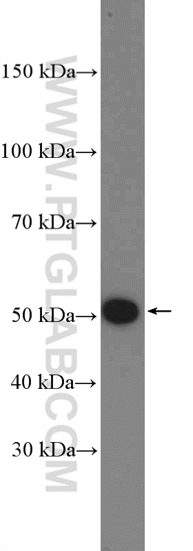 WB analysis of mouse heart using 27261-1-AP