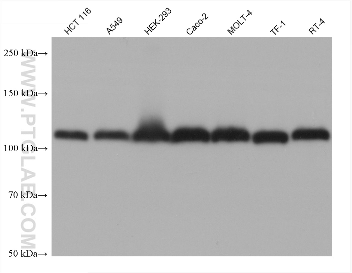 WB analysis using 66630-1-Ig
