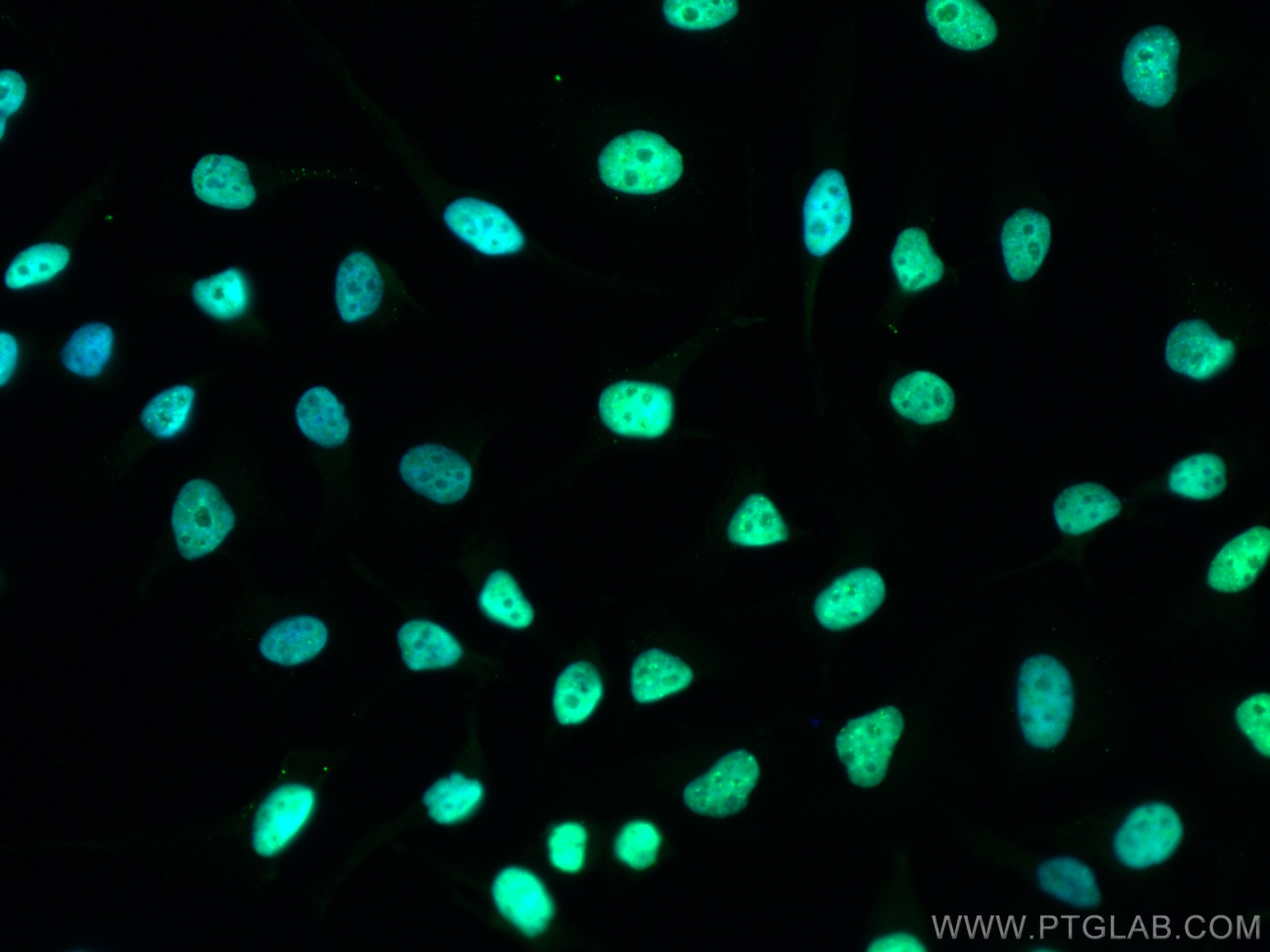 IF Staining of HeLa using CL488-15202