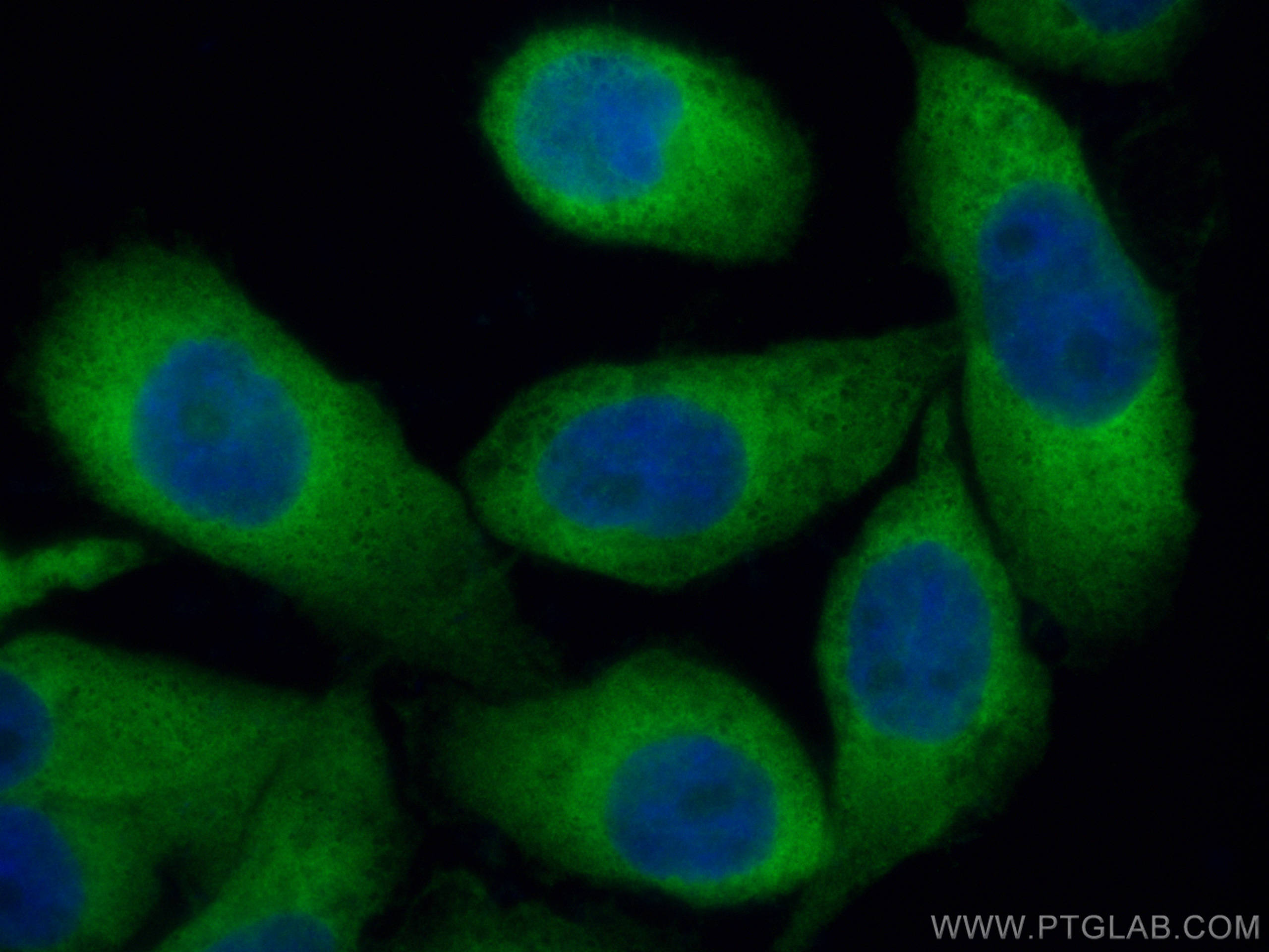 IF Staining of A431 using 14951-1-AP