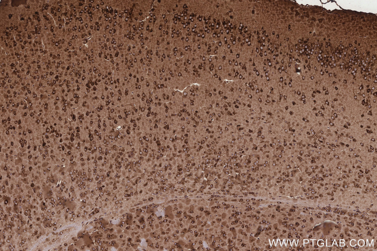 IHC staining of mouse brain using 14951-1-AP IHC staining of mouse brain using 14951-1-AP