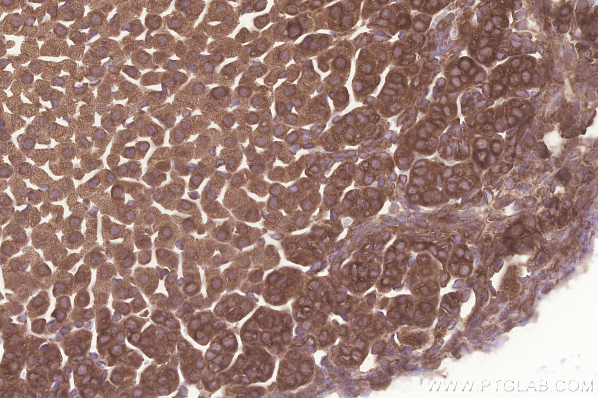 IHC staining of mouse adrenal gland using 14951-1-AP IHC staining of mouse adrenal gland using 14951-1-AP