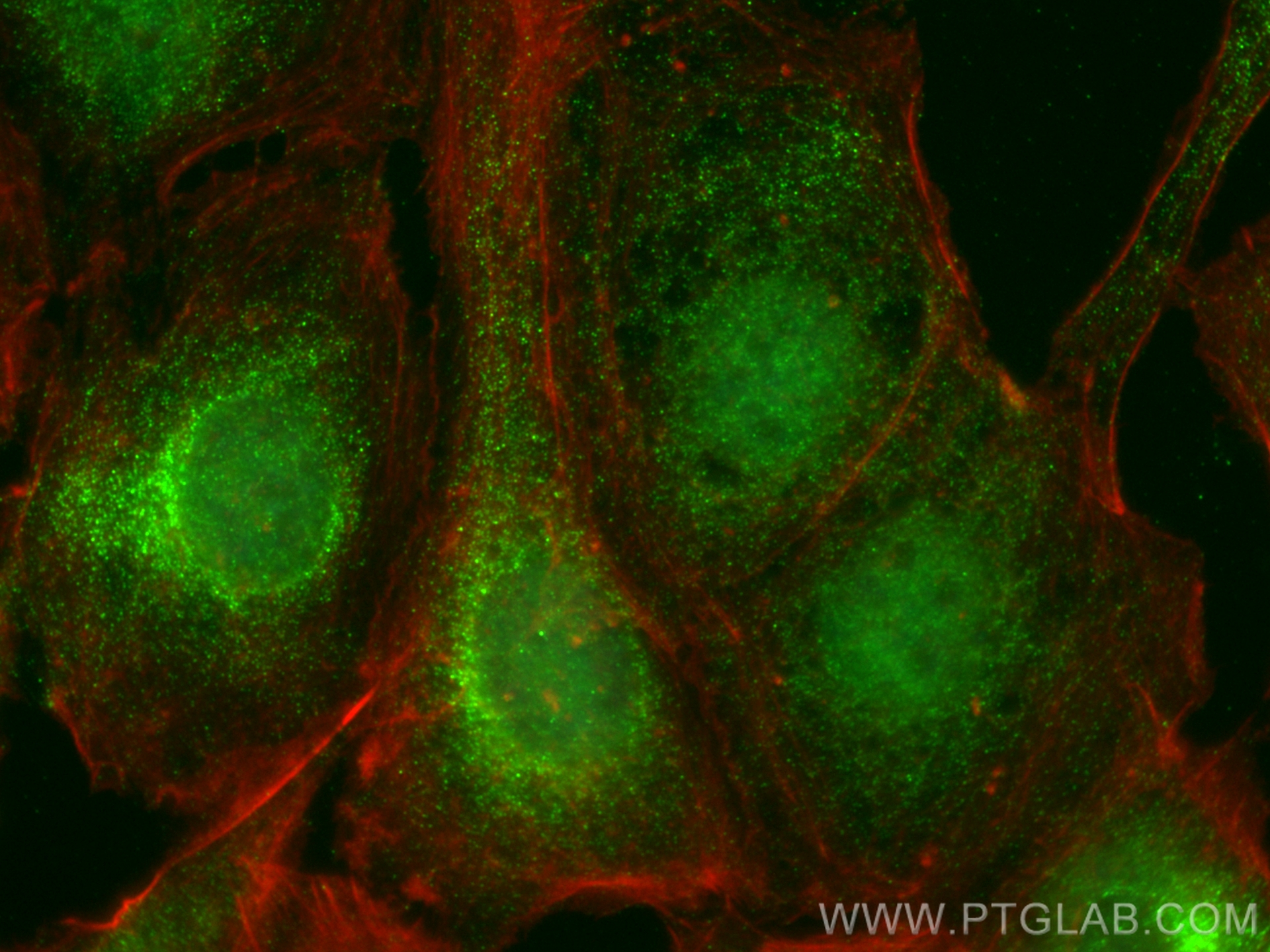 IF Staining of SKOV-3 using 66575-1-Ig