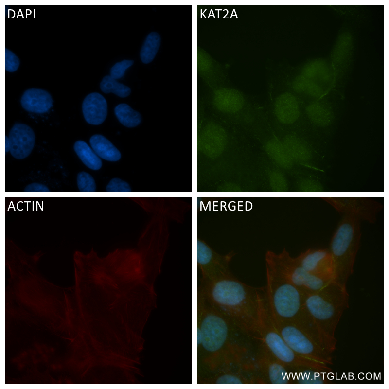 IF Staining of MCF-7 using 84669-2-RR (same clone as 84669-2-PBS)