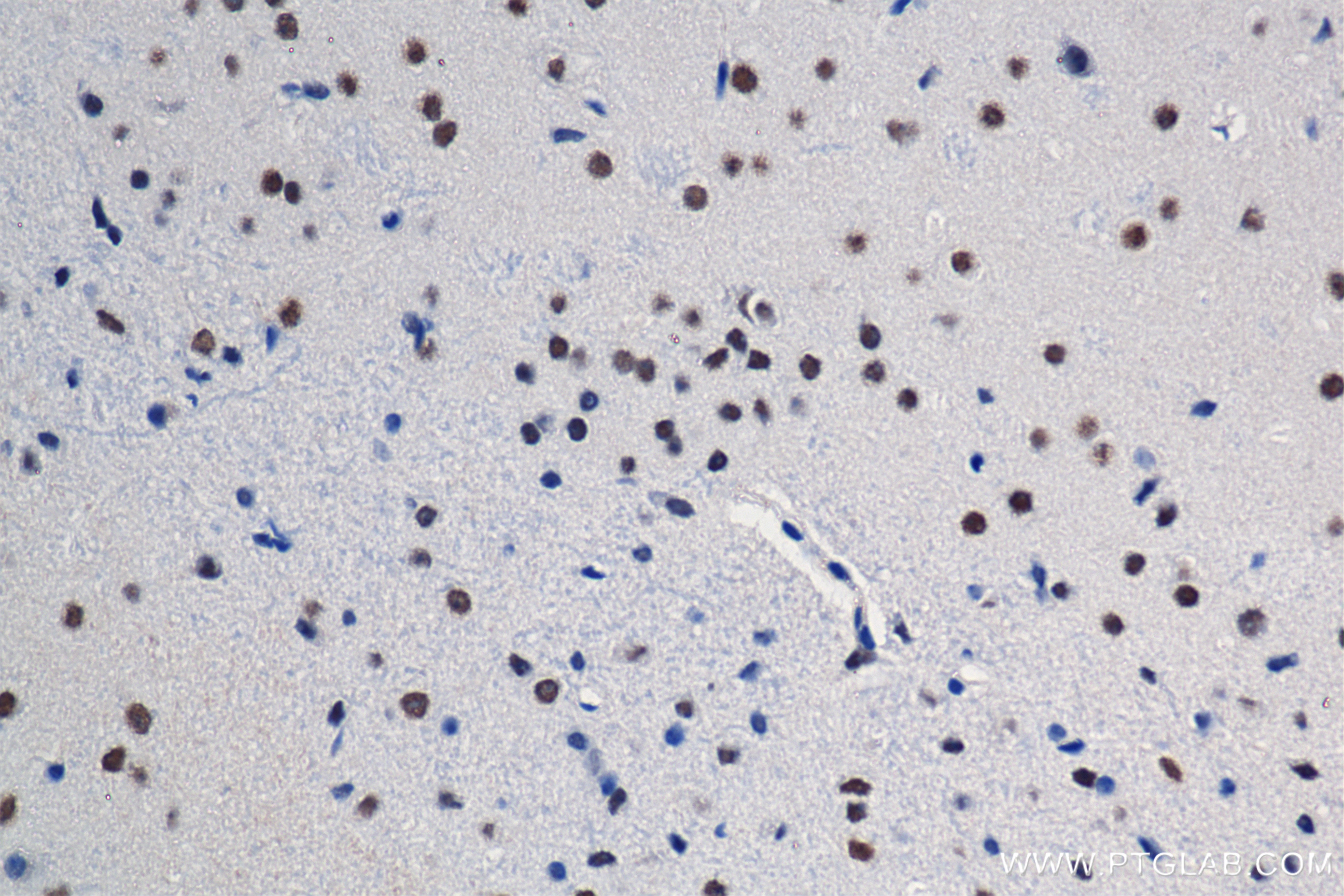 IHC staining of mouse brain using 84669-2-RR