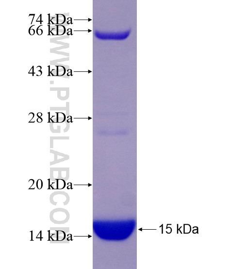 KAT2A fusion protein Ag29021 SDS-PAGE KAT2A fusion protein Ag29021 SDS-PAGE