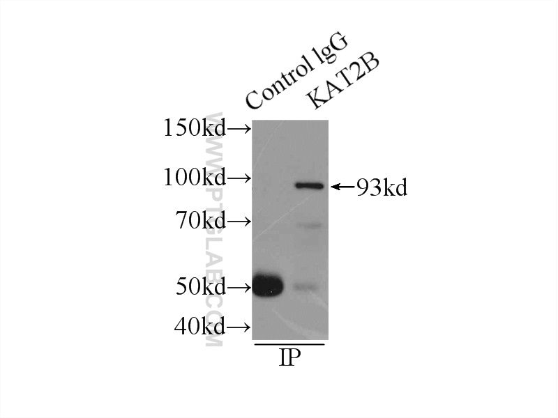 PCAF Polyclonal antibody