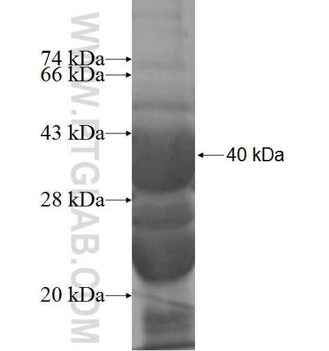 KAT2B fusion protein Ag5787 SDS-PAGE KAT2B fusion protein Ag5787 SDS-PAGE