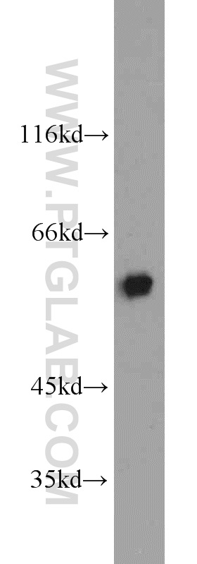 TIP60/KAT5 Polyclonal antibody