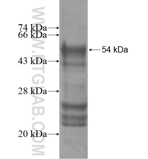 KATNAL1 fusion protein Ag13865 SDS-PAGE KATNAL1 fusion protein Ag13865 SDS-PAGE