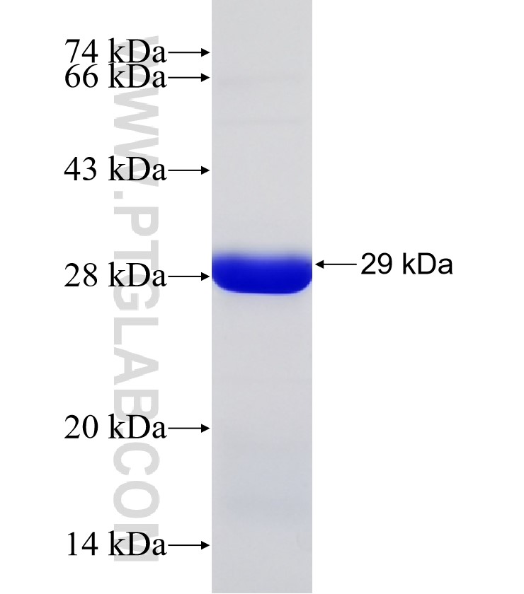KATNAL2 fusion protein Ag31156 SDS-PAGE