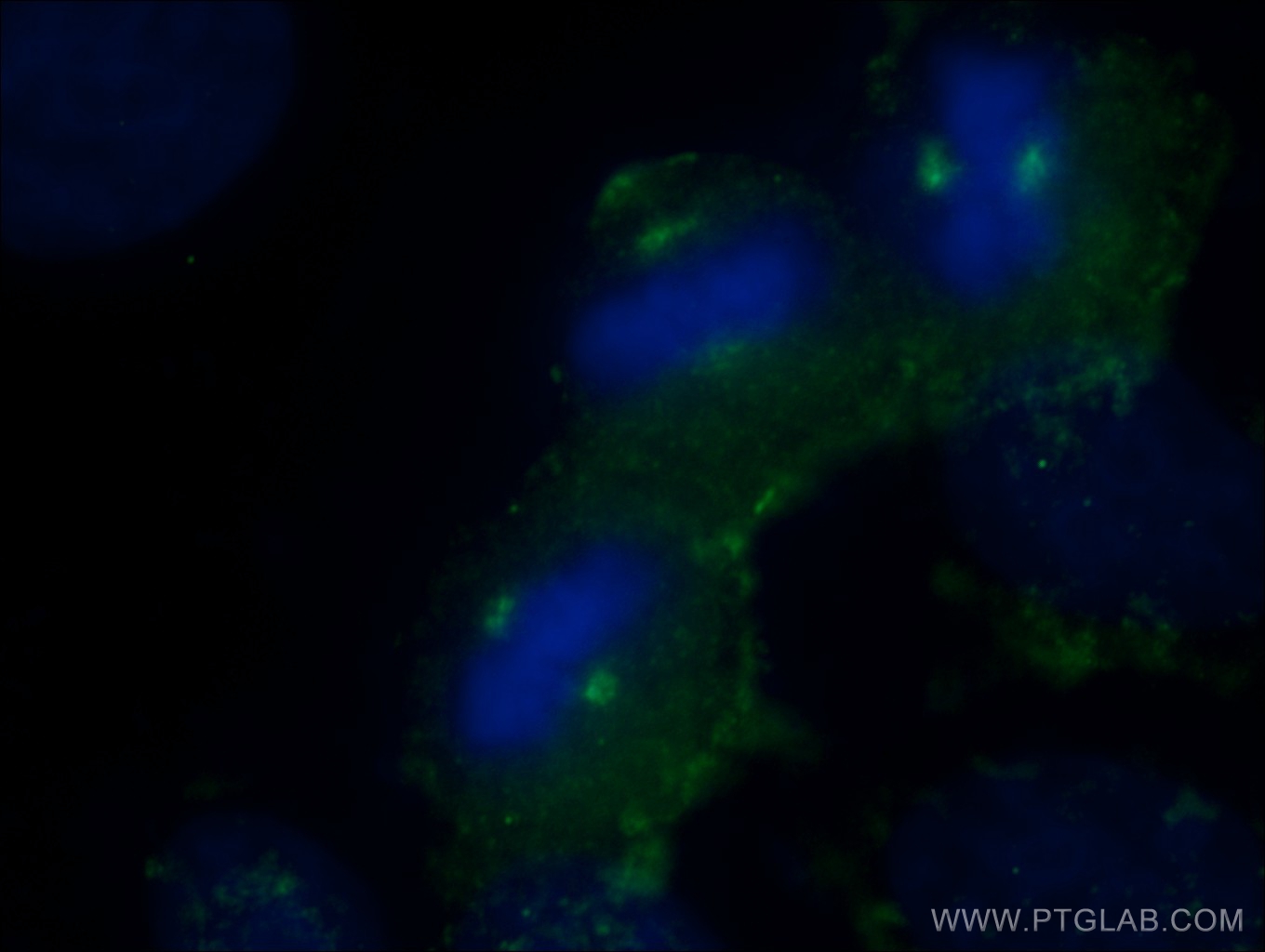 IF Staining of HeLa using 14969-1-AP