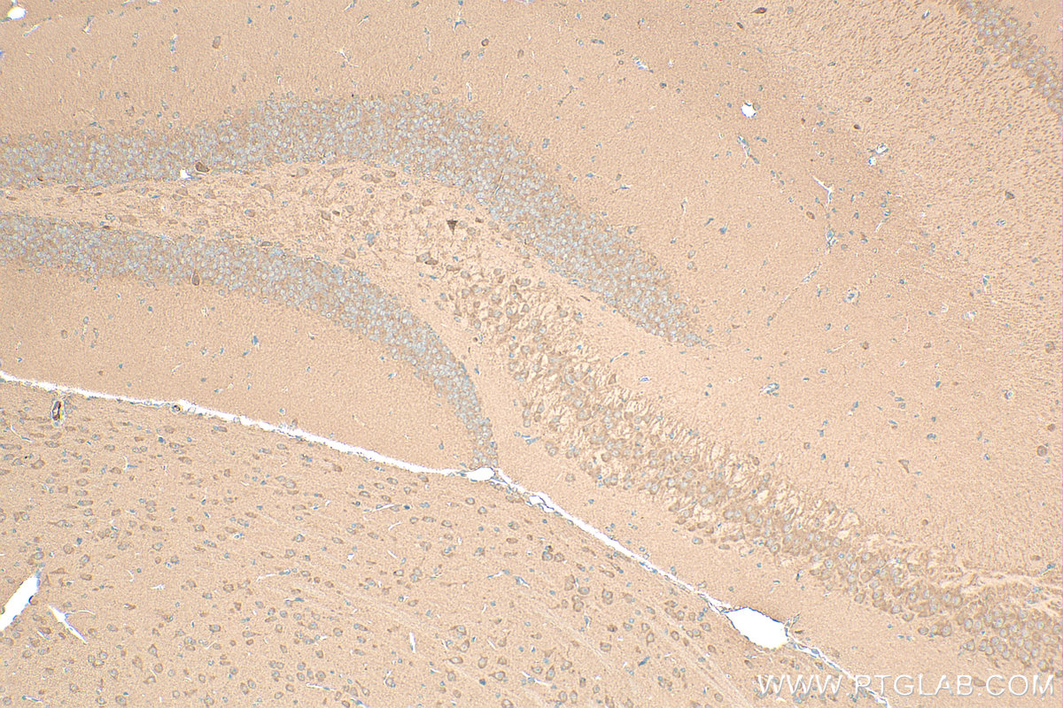 IHC staining of mouse brain using 14969-1-AP