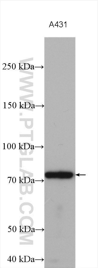 WB analysis using 14969-1-AP