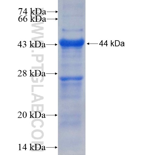 KATNB1 fusion protein Ag14625 SDS-PAGE KATNB1 fusion protein Ag14625 SDS-PAGE