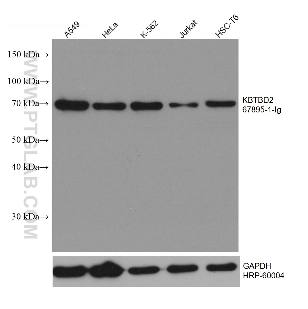 WB analysis using 67895-1-Ig