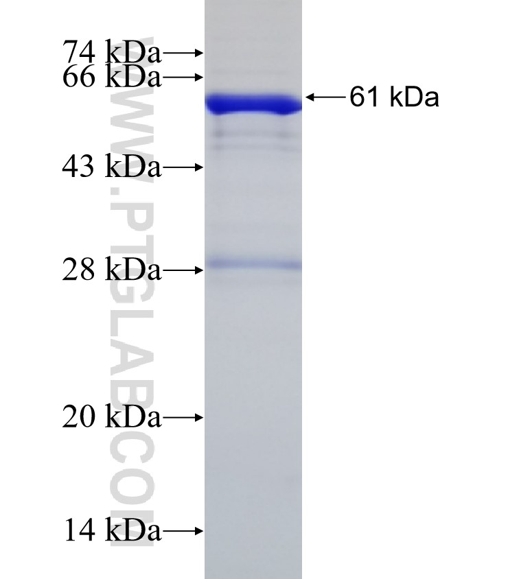 KBTBD2 fusion protein Ag4823 SDS-PAGE