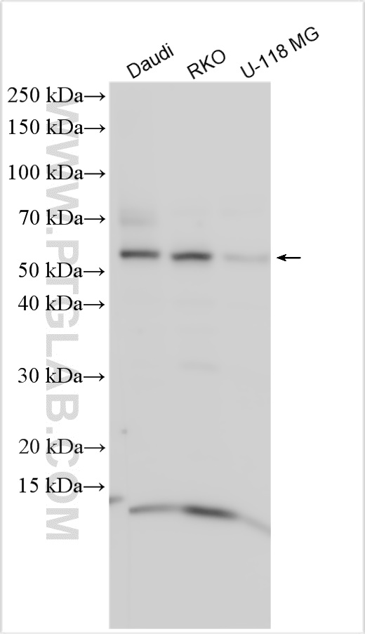 WB analysis using 31970-1-AP