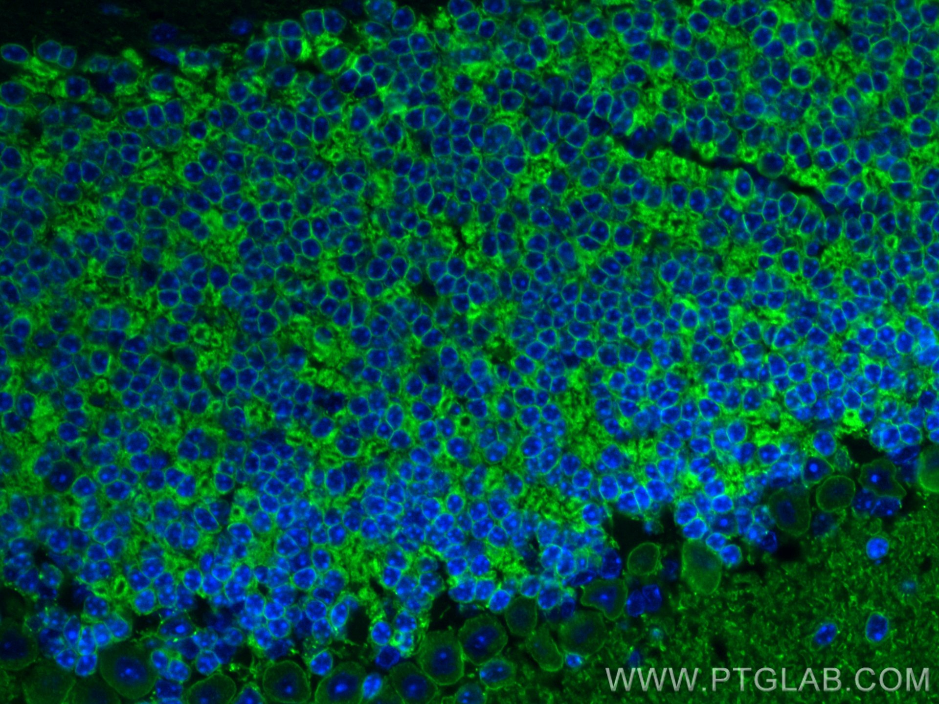 IF Staining of mouse cerebellum using 28724-1-AP