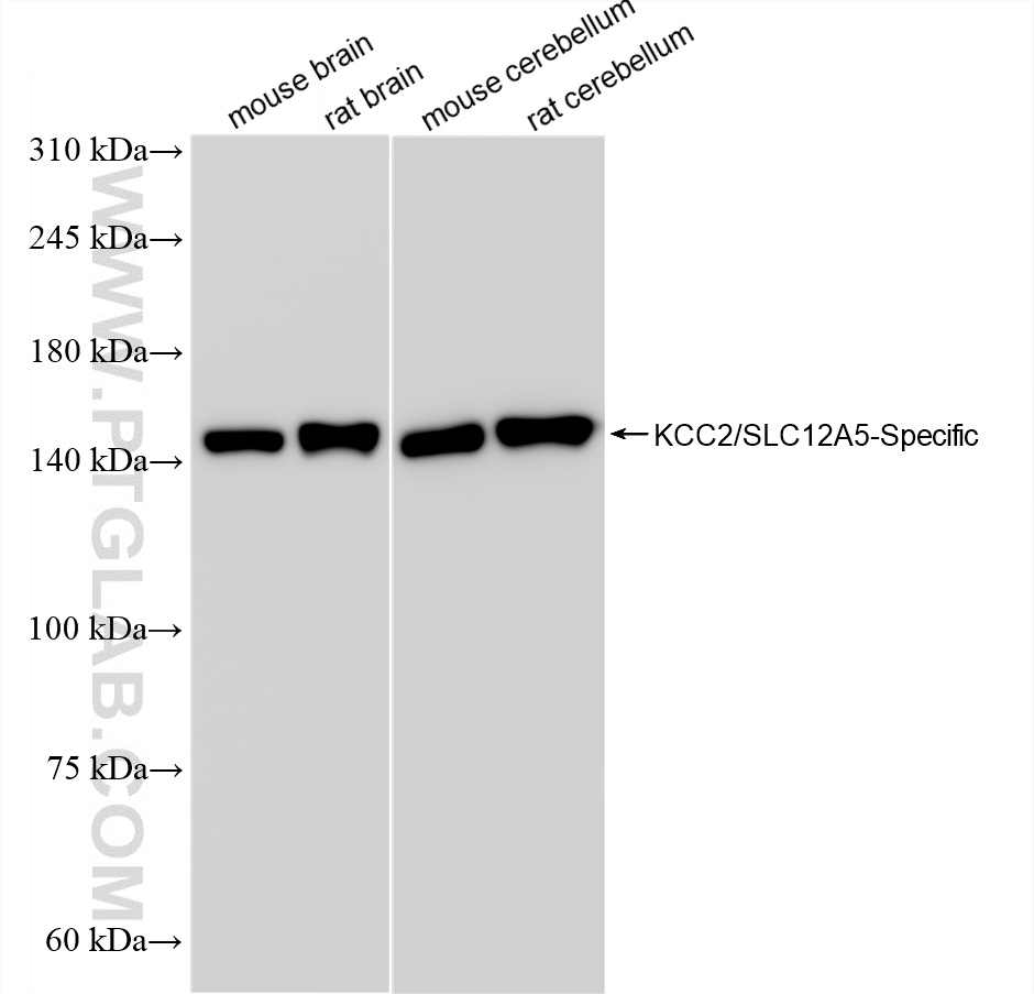 WB analysis using 85751-1-RR