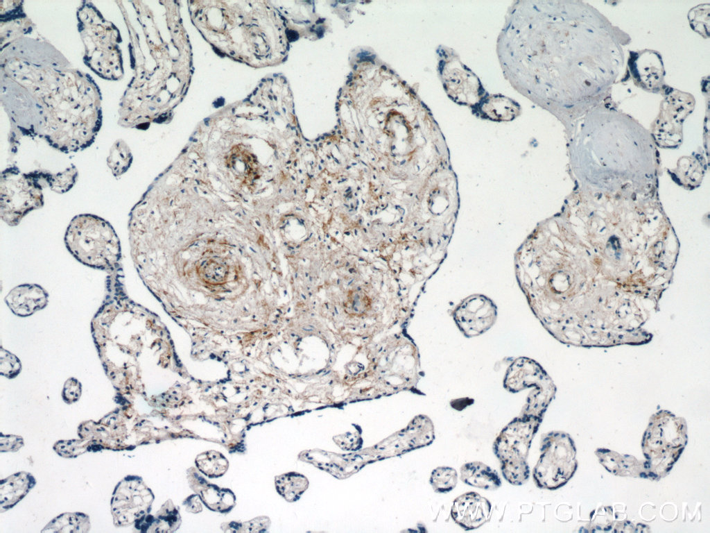 IHC staining of human placenta using 18103-1-AP