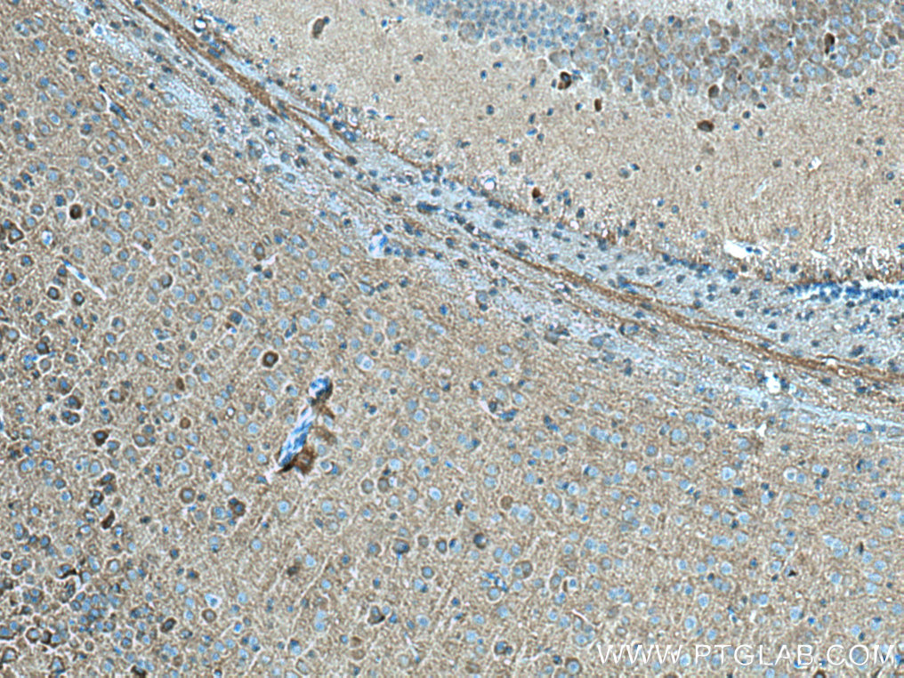 IHC staining of mouse brain using 14235-1-AP