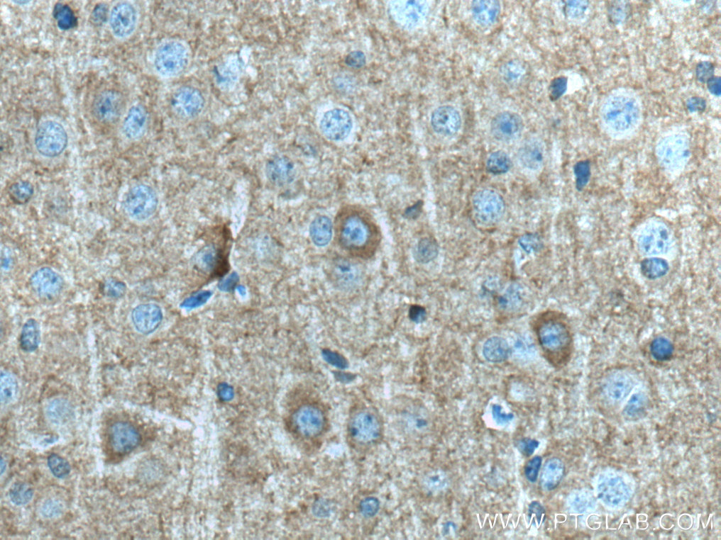 IHC staining of mouse brain using 14235-1-AP