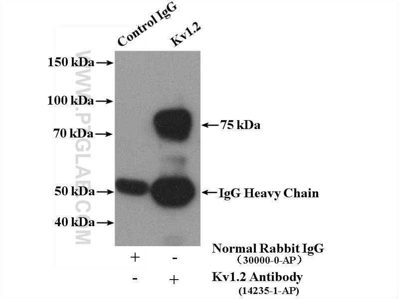 IP experiment of HeLa using 14235-1-AP