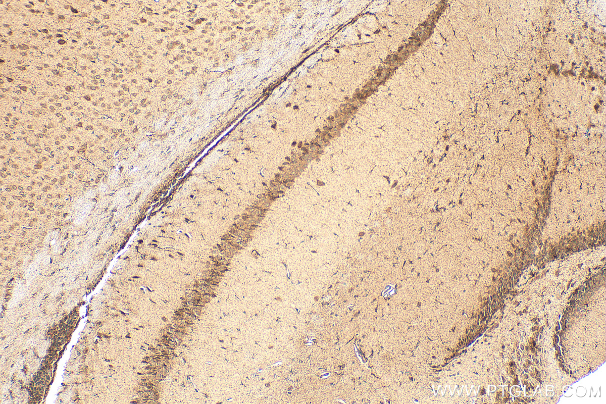 IHC staining of mouse brain using 31900-1-AP