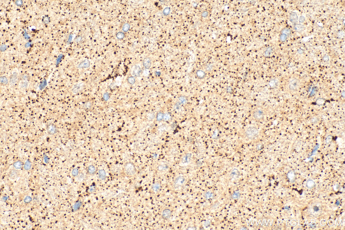 IHC staining of rat brain using 31900-1-AP