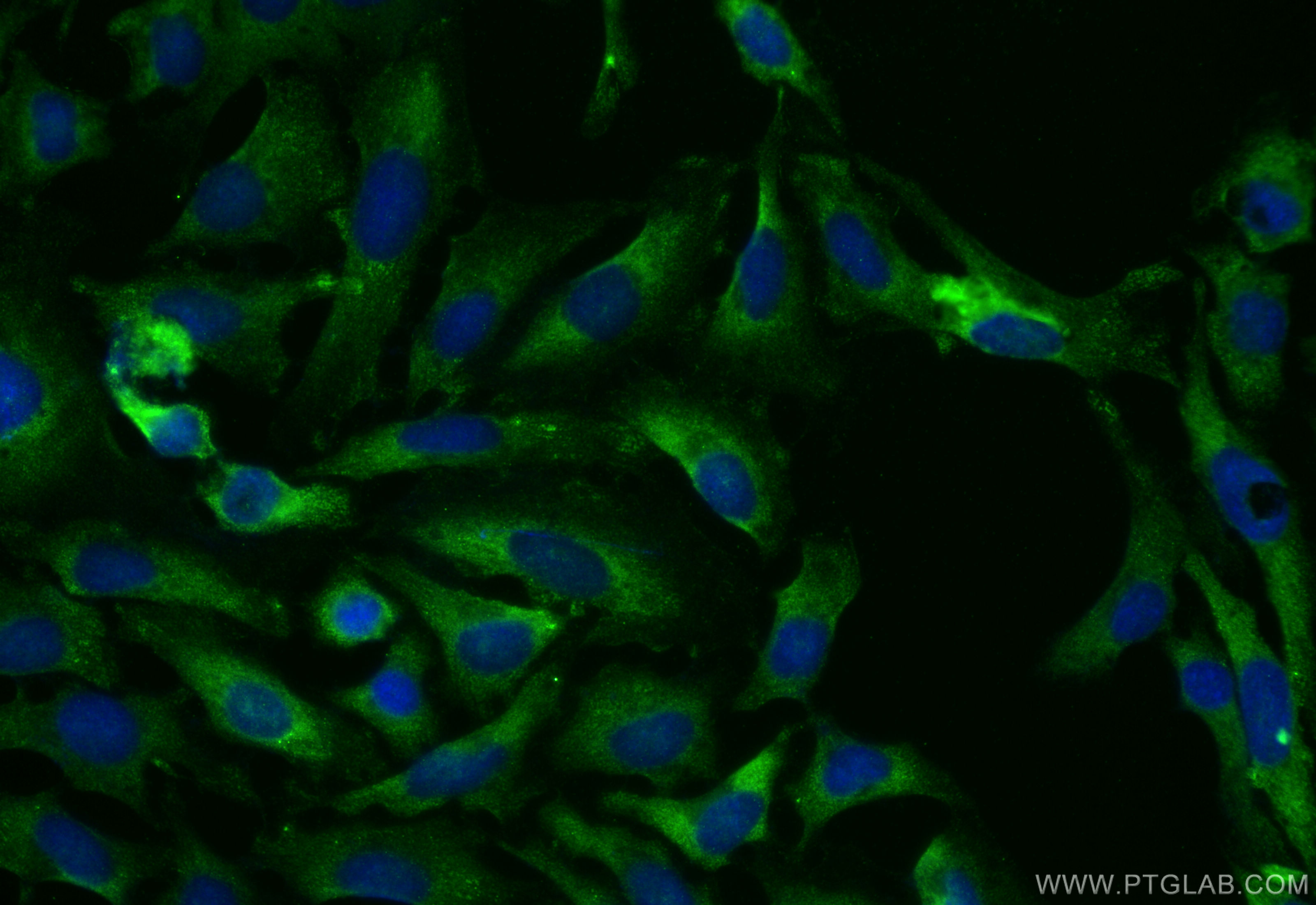 IF Staining of HeLa using 14697-1-AP (same clone as 14697-1-PBS)