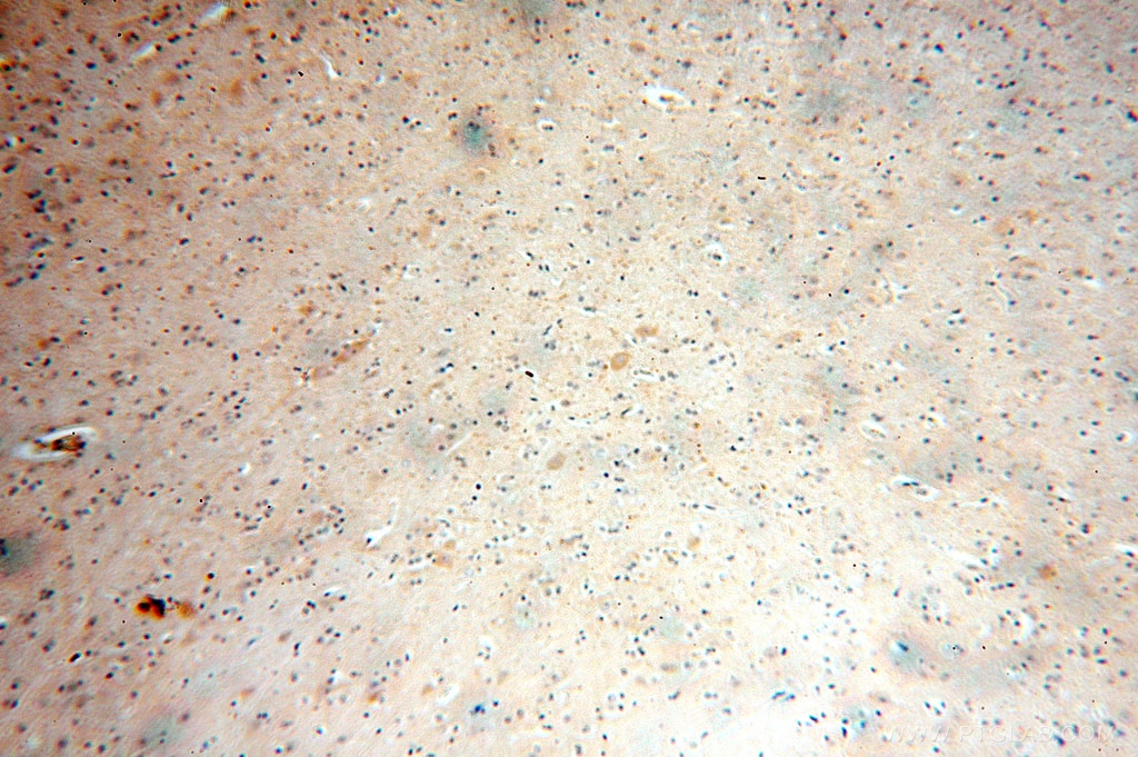 IHC staining of human brain using 14697-1-AP (same clone as 14697-1-PBS)