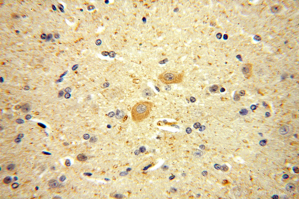 IHC staining of human brain using 14697-1-AP (same clone as 14697-1-PBS)