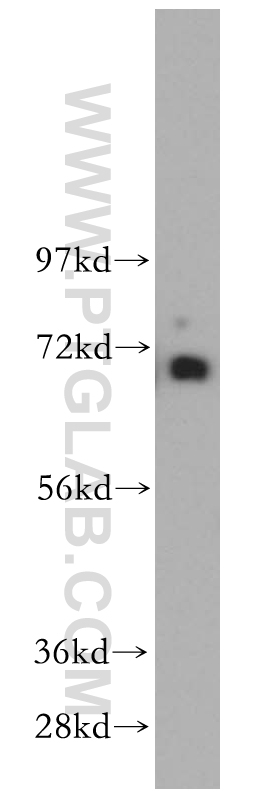 KCNAB1