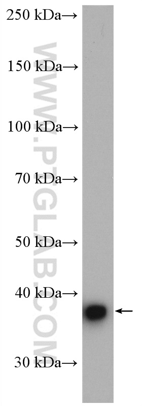 WB analysis of mouse brain using 17890-1-AP