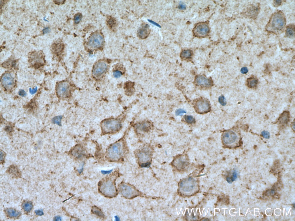 IHC staining of mouse brain using 19963-1-AP