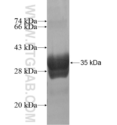KCNC1 fusion protein Ag15985 SDS-PAGE KCNC1 fusion protein Ag15985 SDS-PAGE