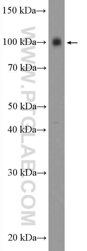 WB analysis of mouse brain using 18092-1-AP