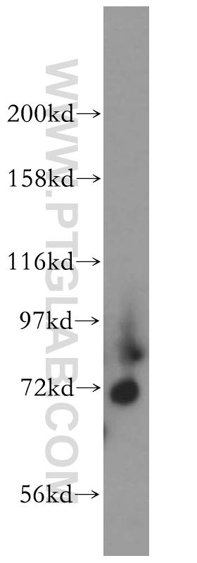 WB analysis of human heart using 13768-1-AP