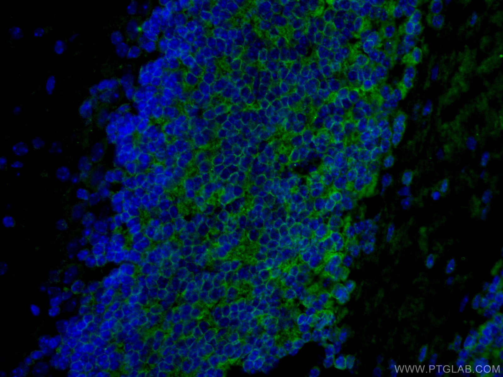 IF Staining of mouse brain using 21298-1-AP