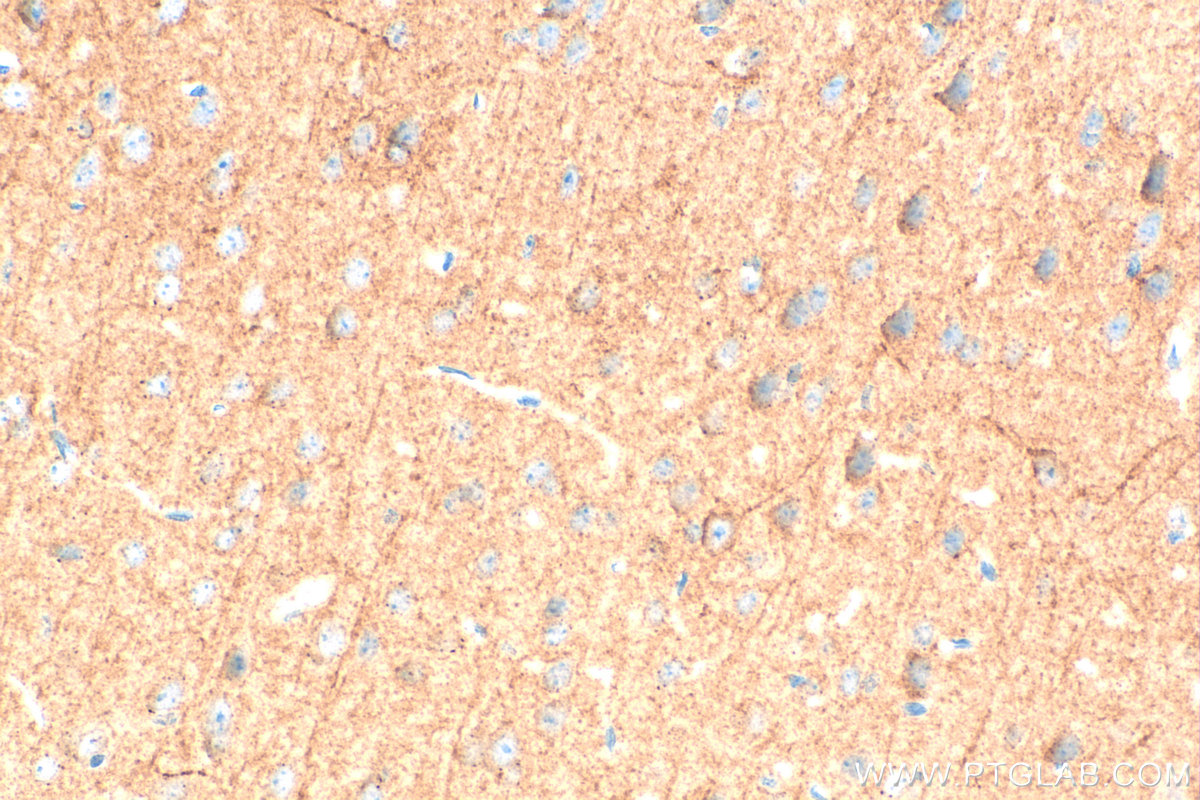 IHC staining of mouse brain using 25468-1-AP