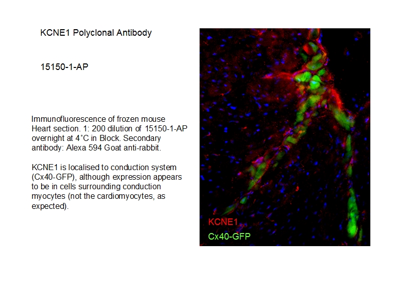 IF Staining of mouse heart tissue using 15150-1-AP