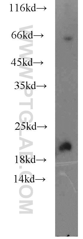 WB analysis of mouse heart using 15150-1-AP