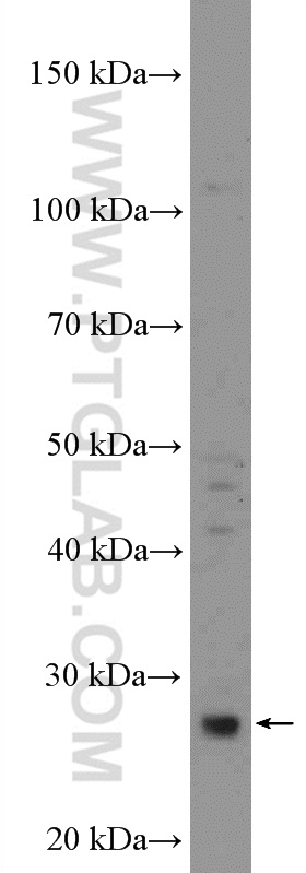 WB analysis of L02 using 18289-1-AP