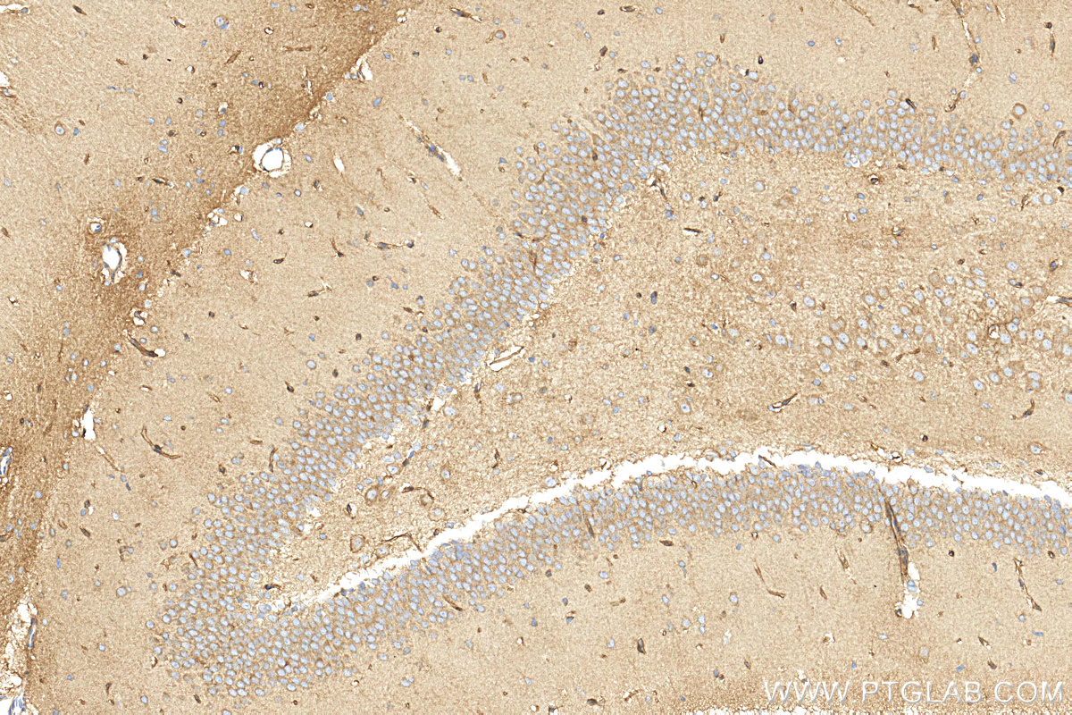 IHC staining of rat brain using 26426-1-AP