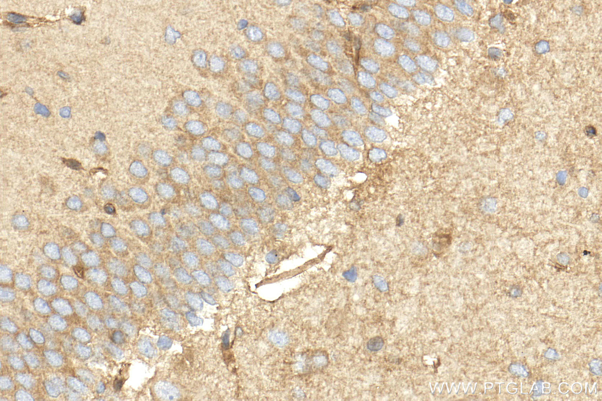 IHC staining of rat brain using 26426-1-AP