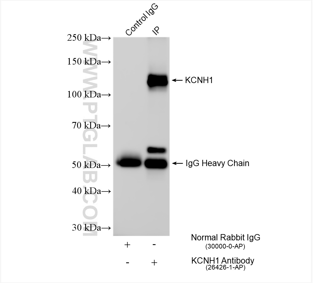 IP experiment of rat brain using 26426-1-AP