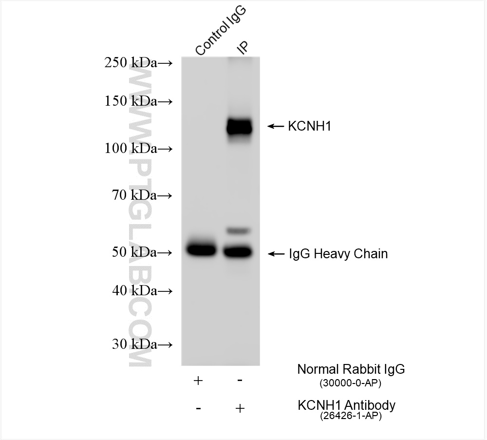 IP experiment of mouse brain using 26426-1-AP