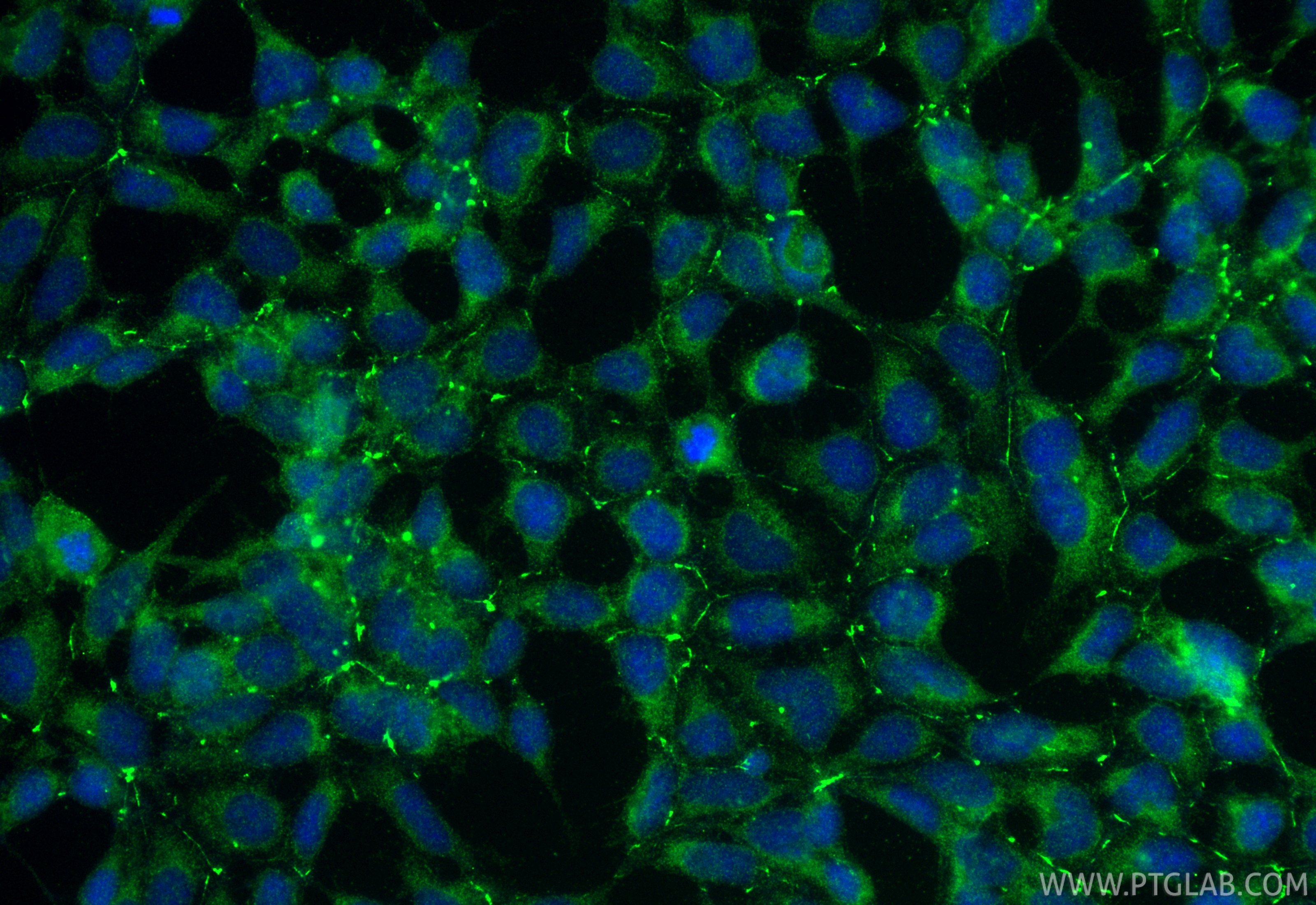 IF Staining of HEK-293 using 30853-1-AP IF Staining of HEK-293 using 30853-1-AP