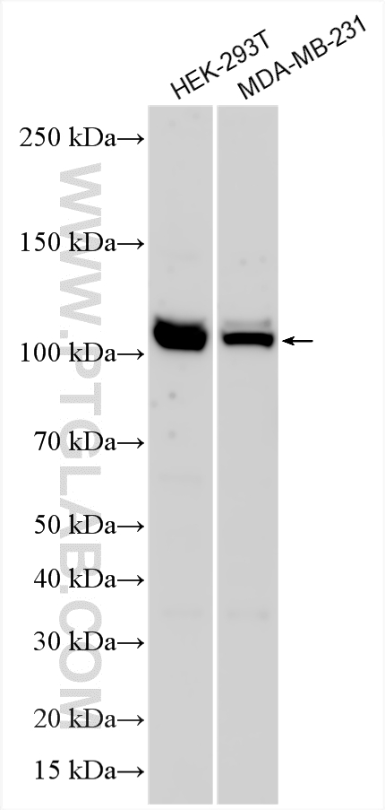 WB analysis using 30853-1-AP (same clone as 30853-1-PBS) WB analysis using 30853-1-AP (same clone as 30853-1-PBS)